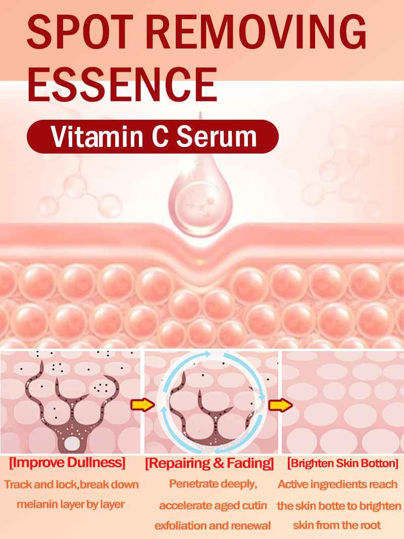 Ilumine sardas melasma, mancha - Luxury Natural Skincare avaliação e preço